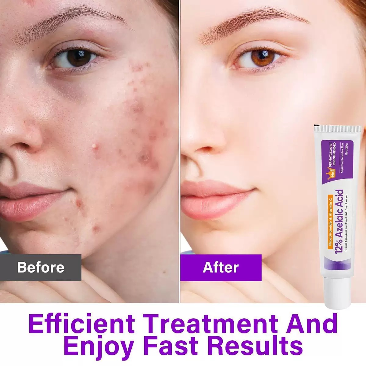 추천! 동아제약멜라논크림 10개 인기 제품 지금 구매하기